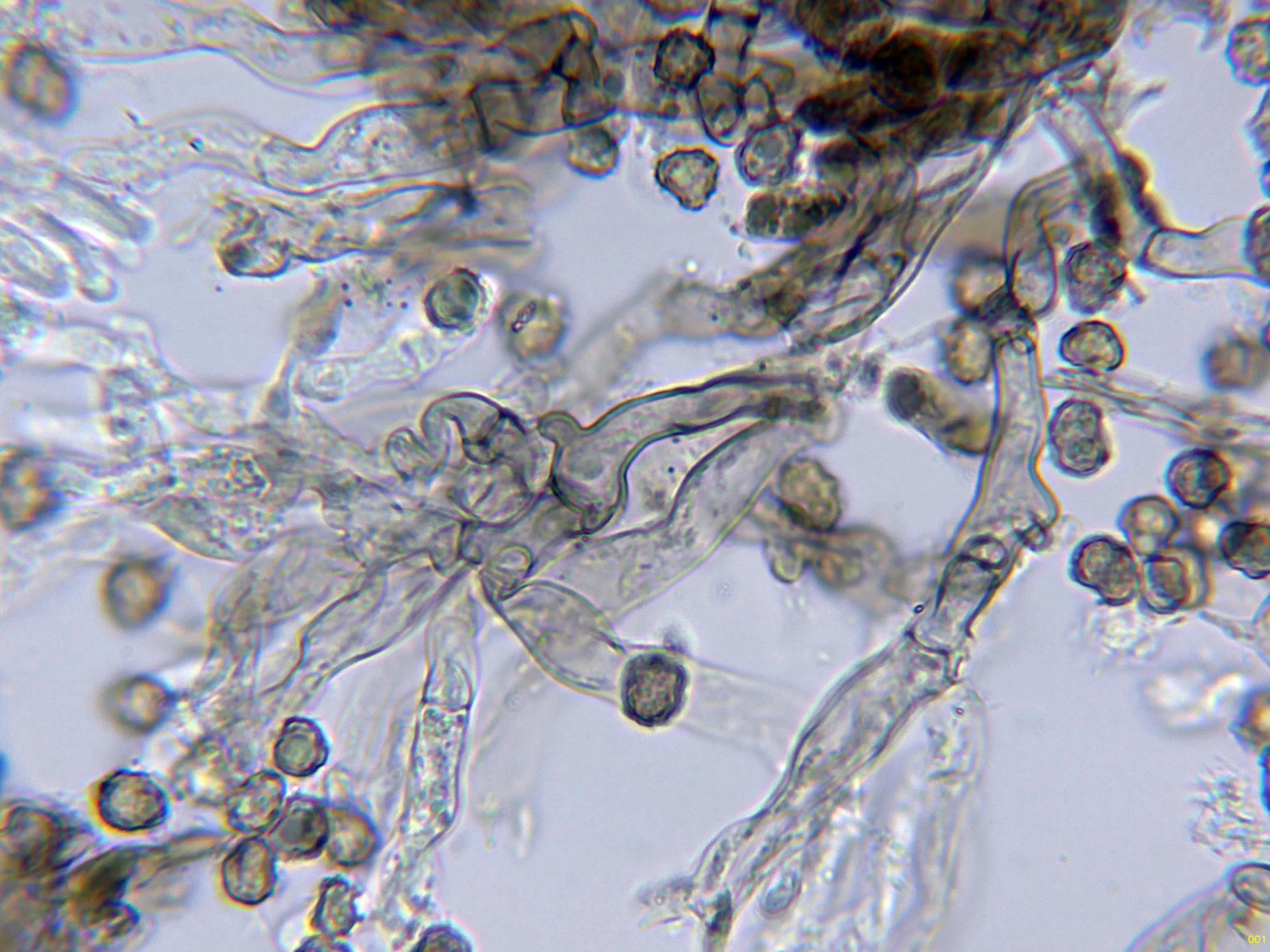 Microscopía de Tomentella radiosa - 10 - Hifas subhimeniales KOH-001
